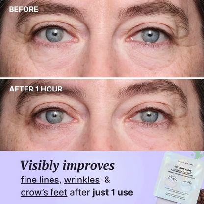 Dermora™ Collagen Infused Eye Patches