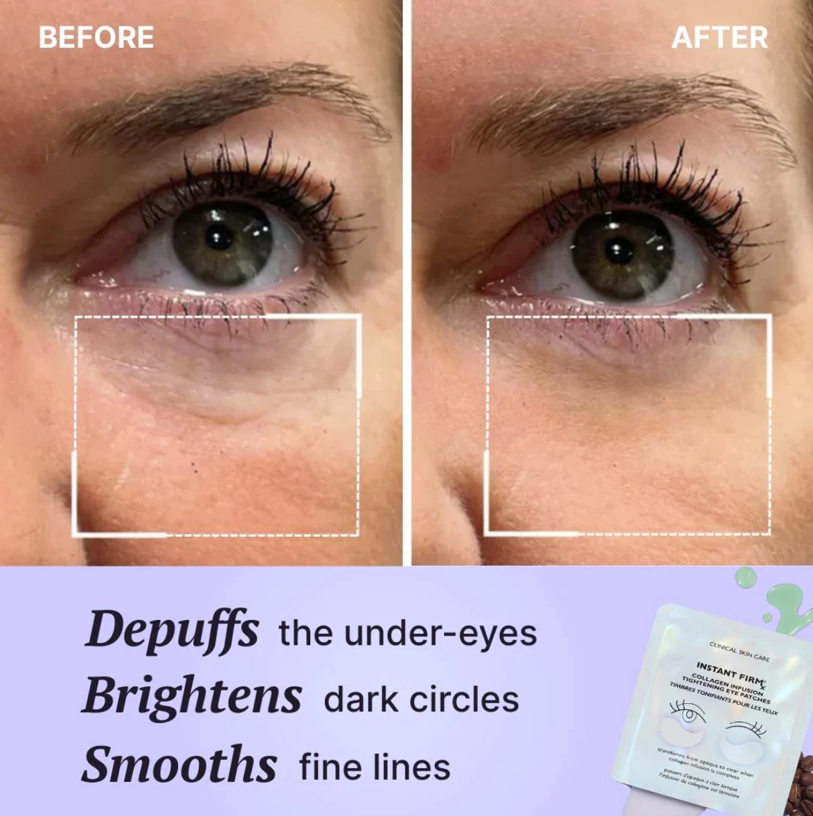 Dermora™ Collagen Infused Eye Patches