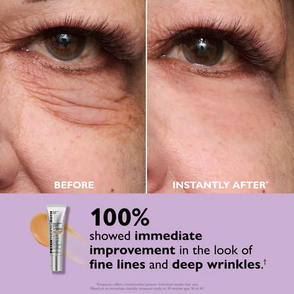 Peter Thomas Roth™ Eye Tightener