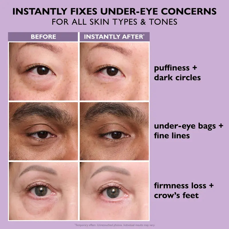 Peter Thomas Roth™ Eye Tightener