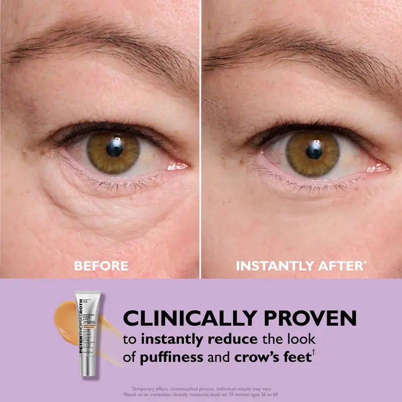Peter Thomas Roth™ Eye Tightener